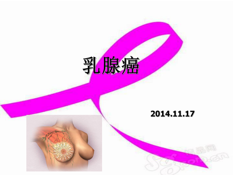 乳腺癌業(yè)務學習.ppt_第1頁