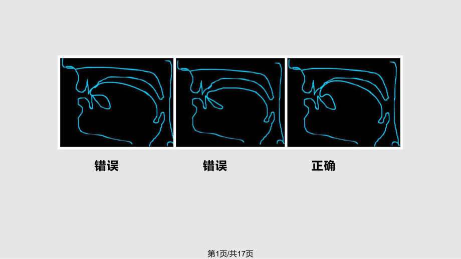 舌面音 jqxPPT課件_第1頁(yè)