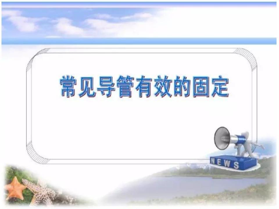 《各種導管固定》PPT課件.ppt_第1頁