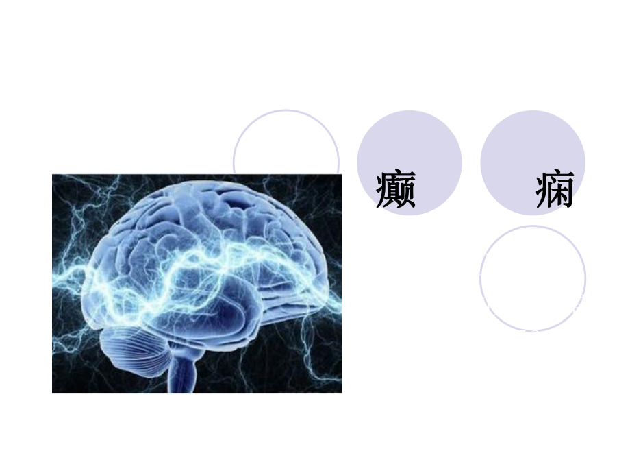 癲癇t演示文稿_第1頁(yè)