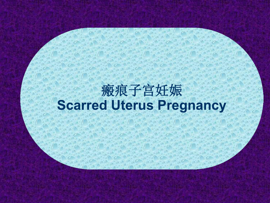 瘢痕妊娠的超声诊断.ppt_第1页