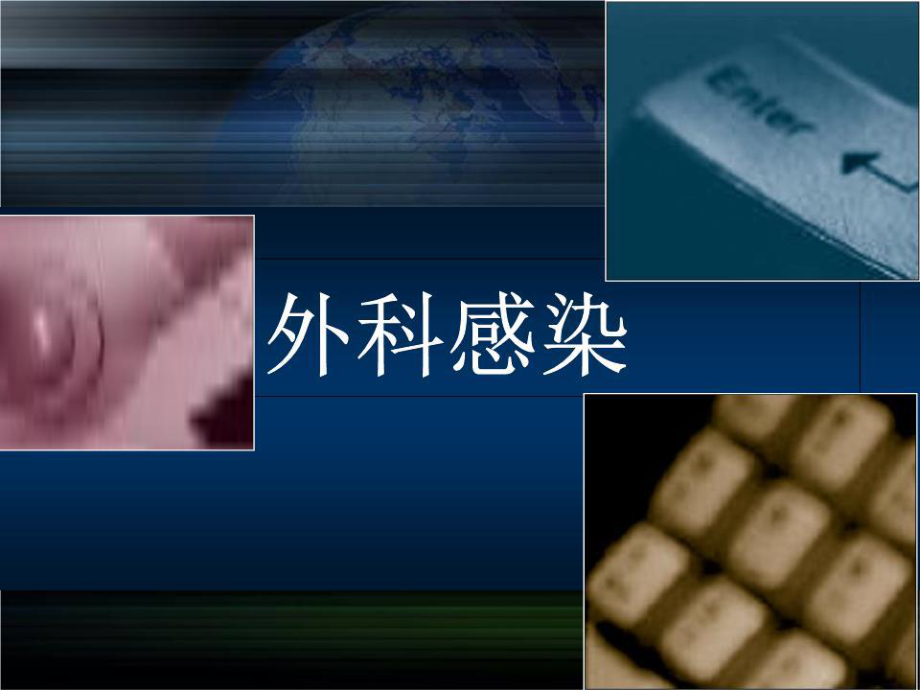 《外科感染》PPT課件.ppt_第1頁