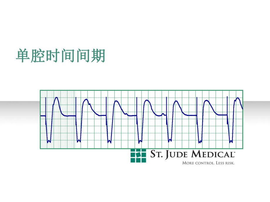 起搏器培训课件：07A_单腔时间间期_第1页