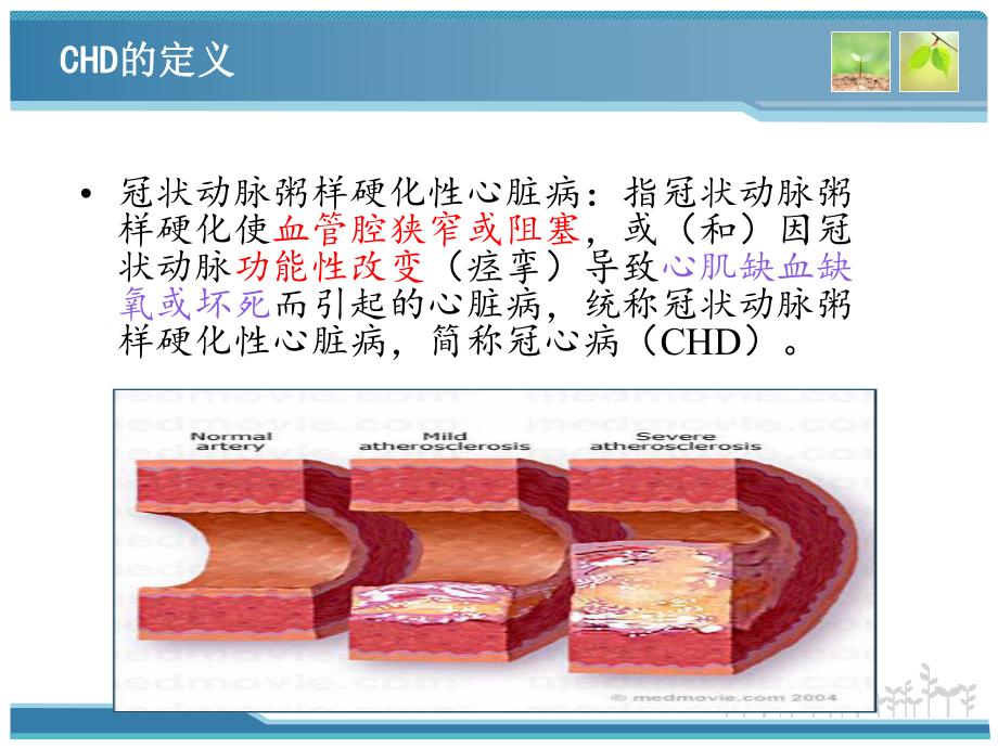 临床病例分析:不稳定型心绞痛患者的病例分析