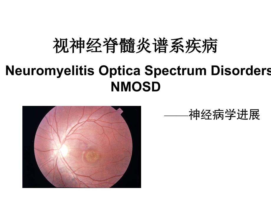 视神经脊髓炎谱系疾病-课件_第1页