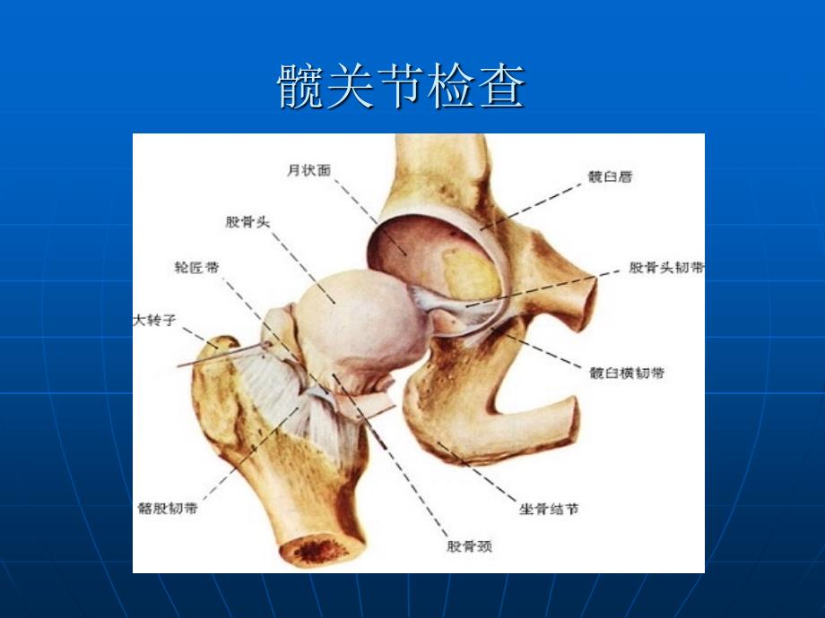 《髋关节体格检查》PPT课件_第1页