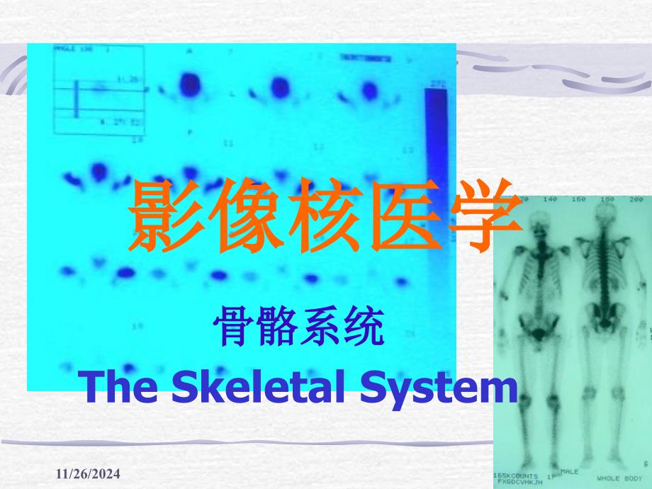 核医学骨骼系统_第1页