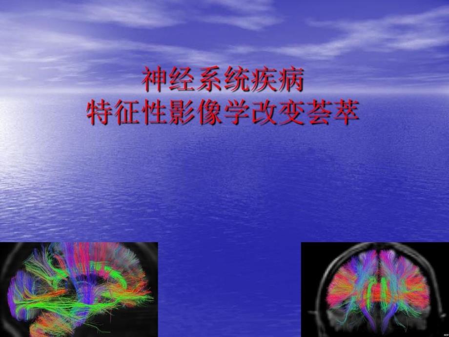 神经系统疾病的特异性影像学荟萃课件_第1页