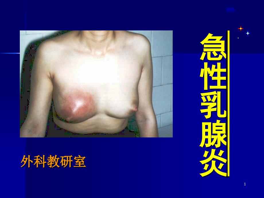 急性乳腺炎外科治疗_第1页