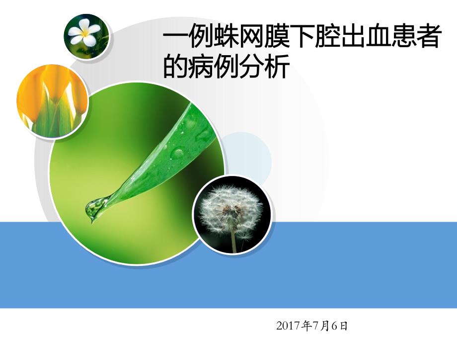 蛛网膜下腔出血患者的病例分析_第1页