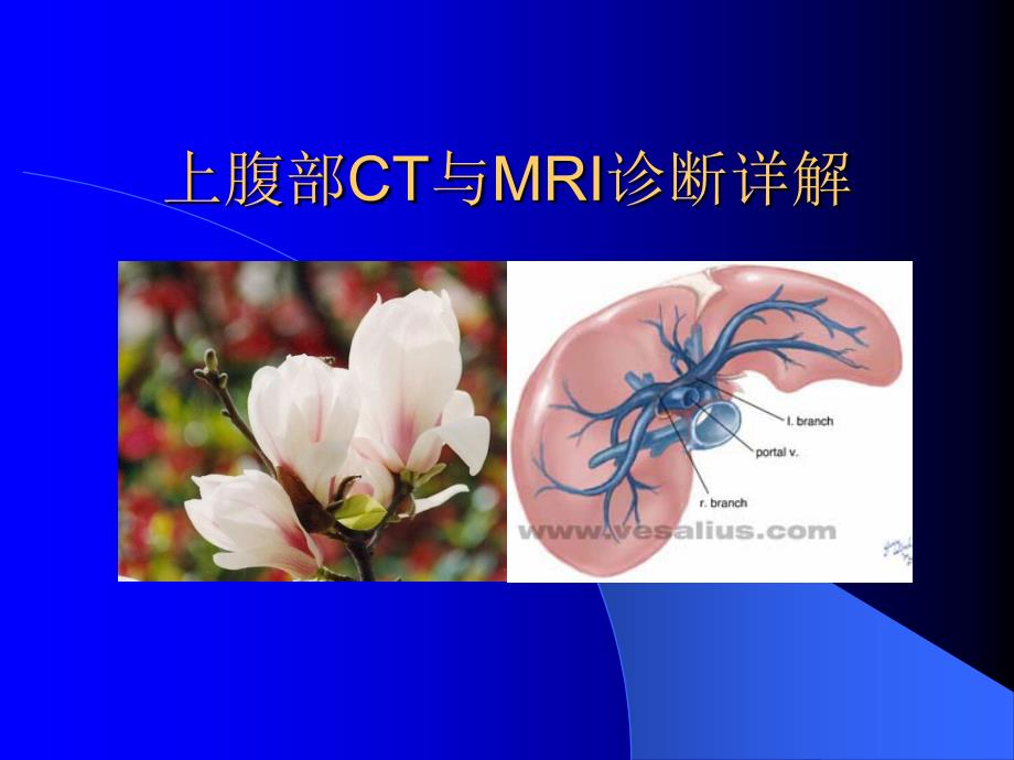 上腹部CT与MRI诊断详解课件_第1页