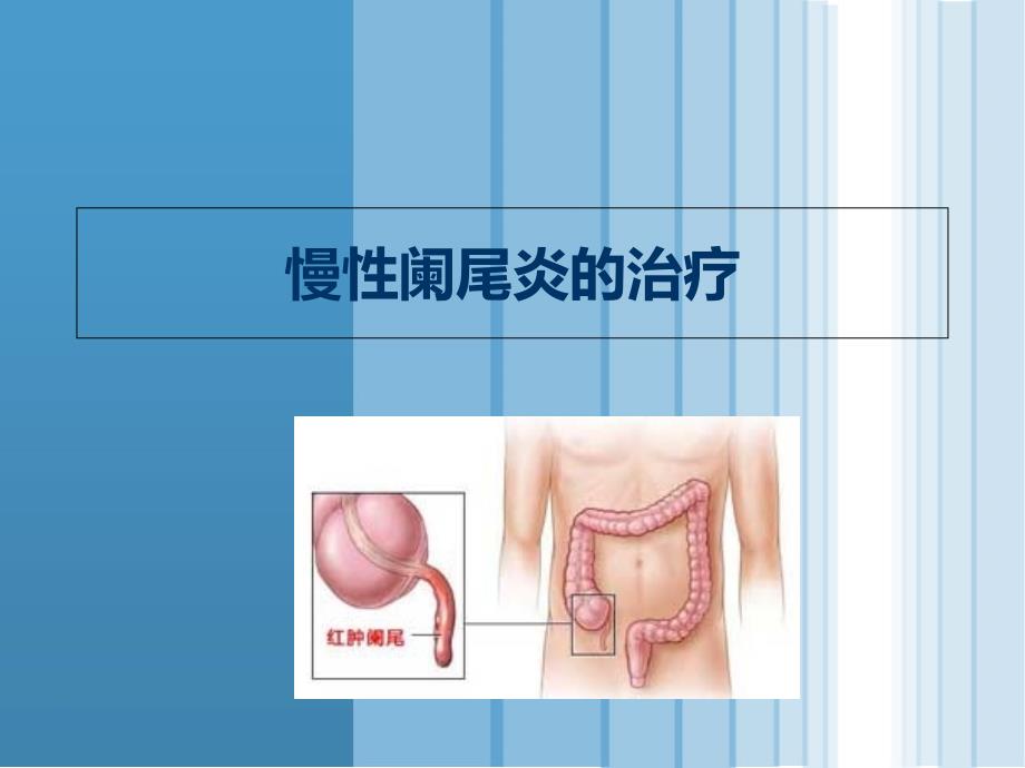 慢性阑尾炎的治疗_第1页