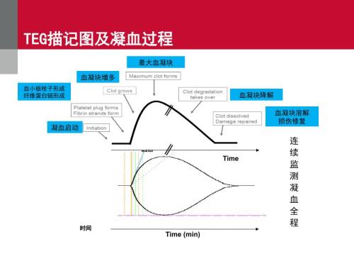 TEG血栓彈力圖的臨床應(yīng)用課件