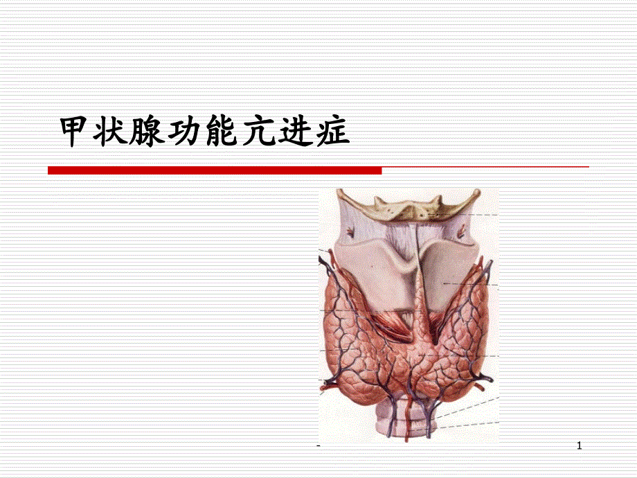 关于甲状腺功能亢进症课件_第1页