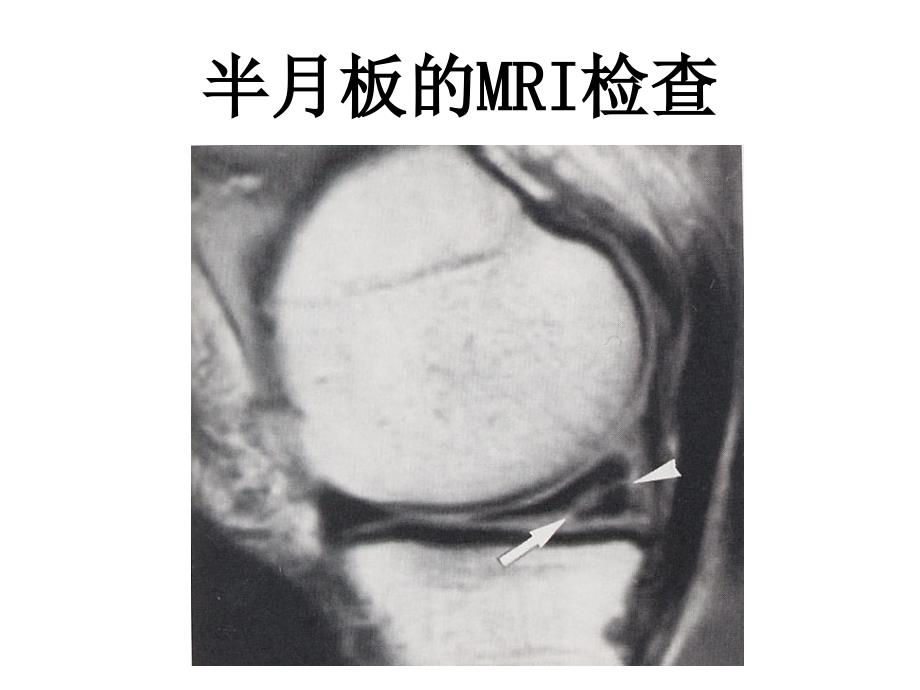 磁共振原理和临床应用（三）_第1页