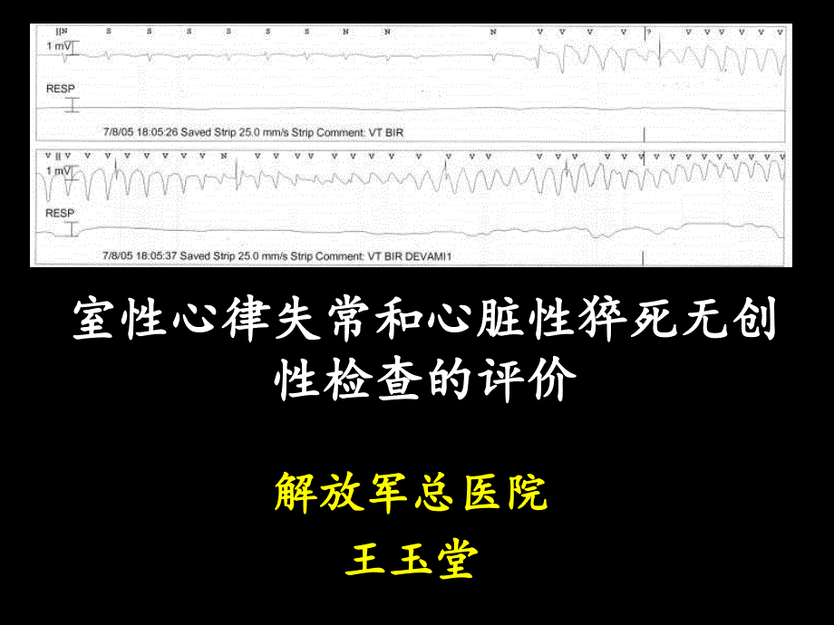 室性心律失常和心脏性猝死无创性检查的评价_第1页