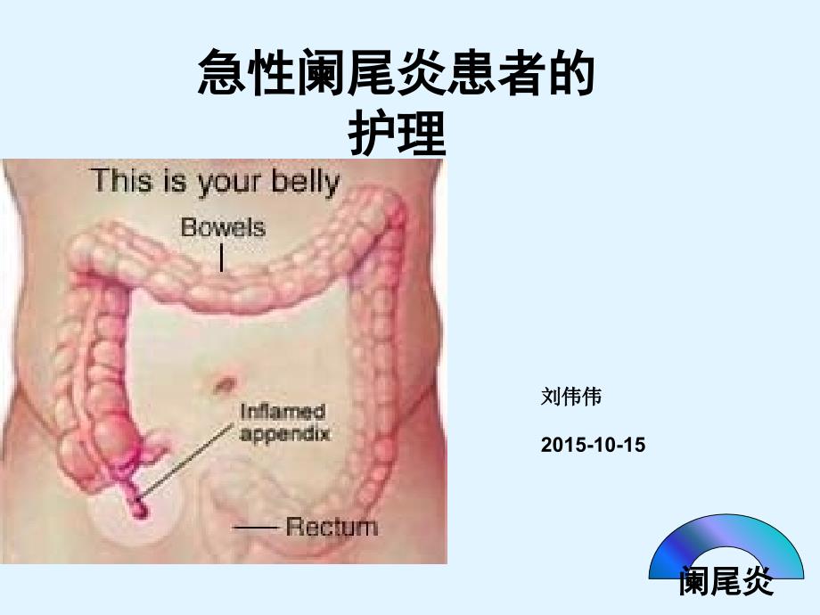 急性阑尾炎患者的护理_第1页