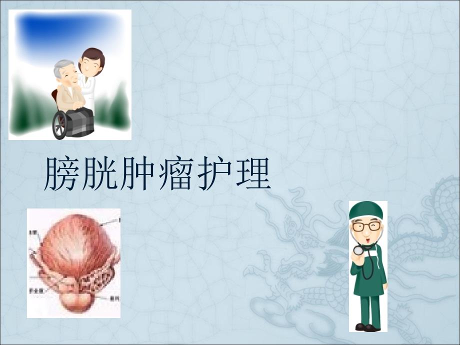 膀胱腫瘤護(hù)理課件_第1頁(yè)