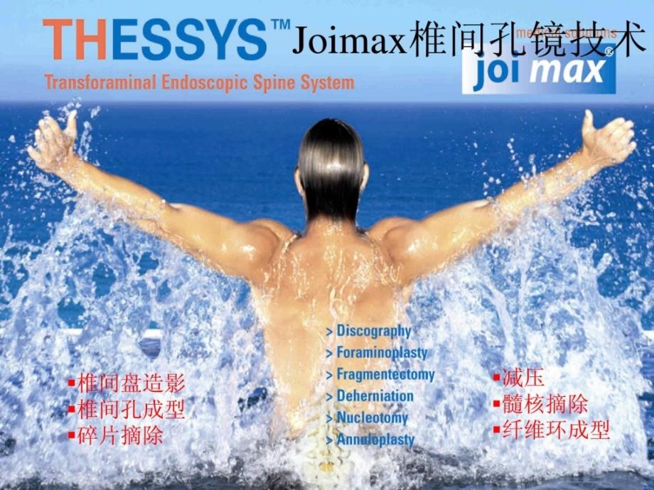 joimax椎间孔镜技巧临床医学医药卫生专业课件_第1页