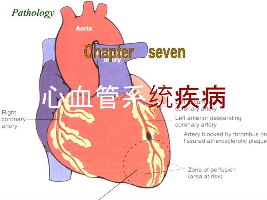 病理学(第八版)最新课件心血管系统疾病_第1页