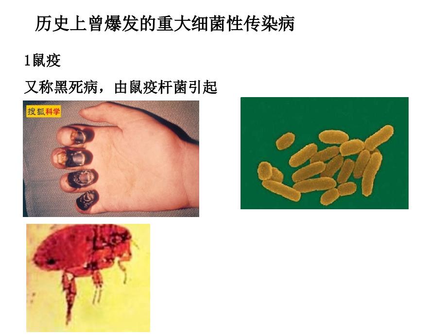 历史上爆发的细菌性传染病解析_第1页