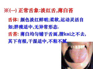 中医诊断学舌诊图谱