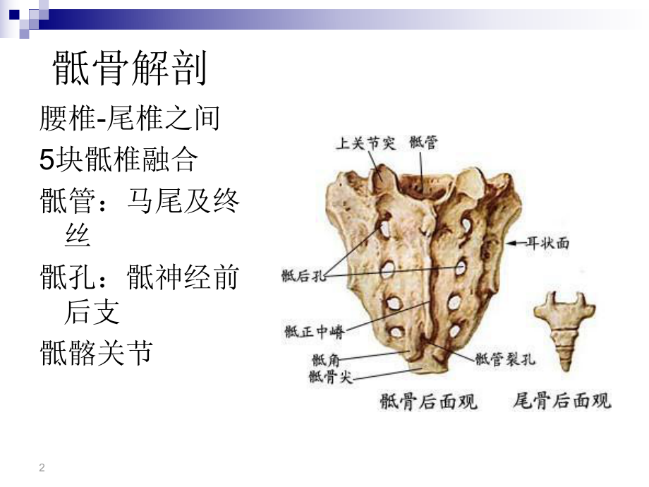 骶骨肿瘤课件