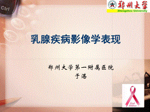 乳腺疾病影像表现于湛郑州
