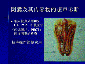 医学PPT课件阴囊及其内容物的超声诊断