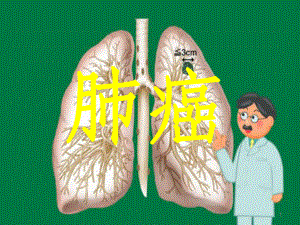 肺癌的诊断与治疗PPT课件.ppt