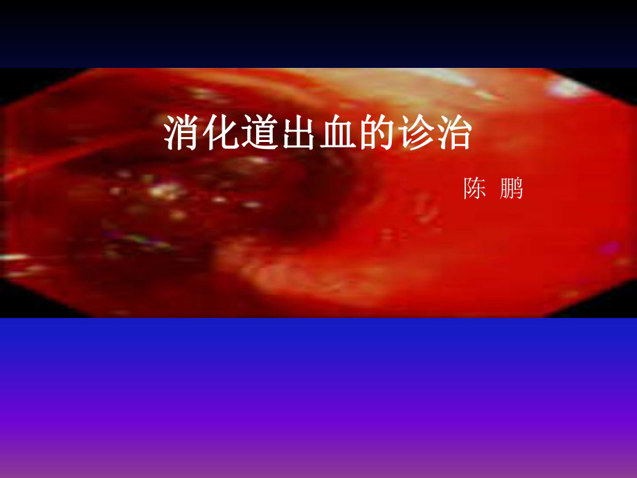 课件：消化道出血的诊治.ppt_第1页