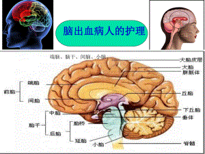 腦出血的護理PPT課件.ppt