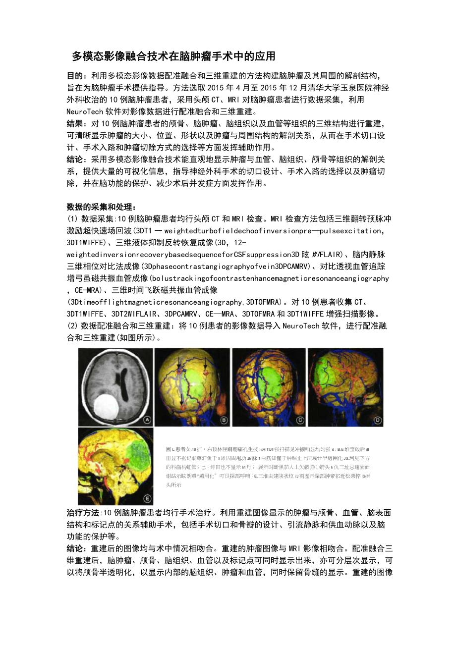 2,多模態(tài)影像融合技術(shù)在腦腫瘤 手術(shù)中的應(yīng)用_第1頁