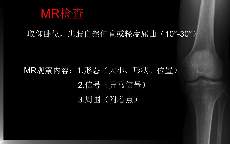 医学ppt课件膝关节MRI_第1页