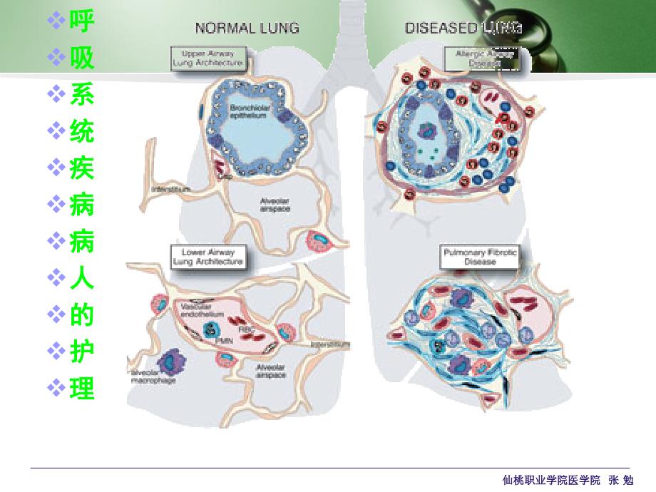 呼吸系统一般护理和常见症状 课件_第1页