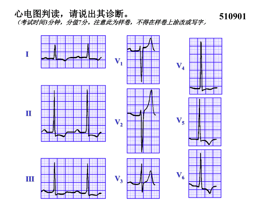 执业医师实践技能考核三心电图试题集课件_第1页