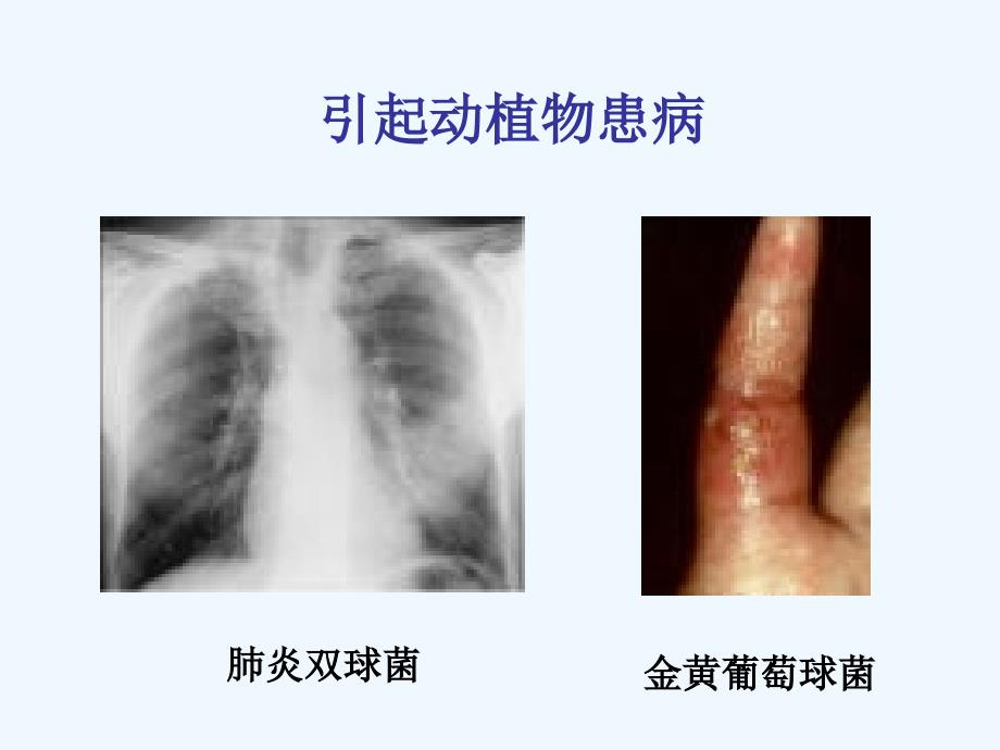 引起动植物和人患病_第1页