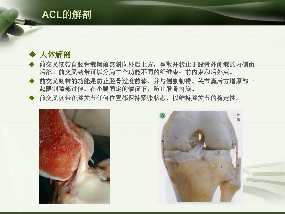 ACL损伤影像学诊断教程_第1页