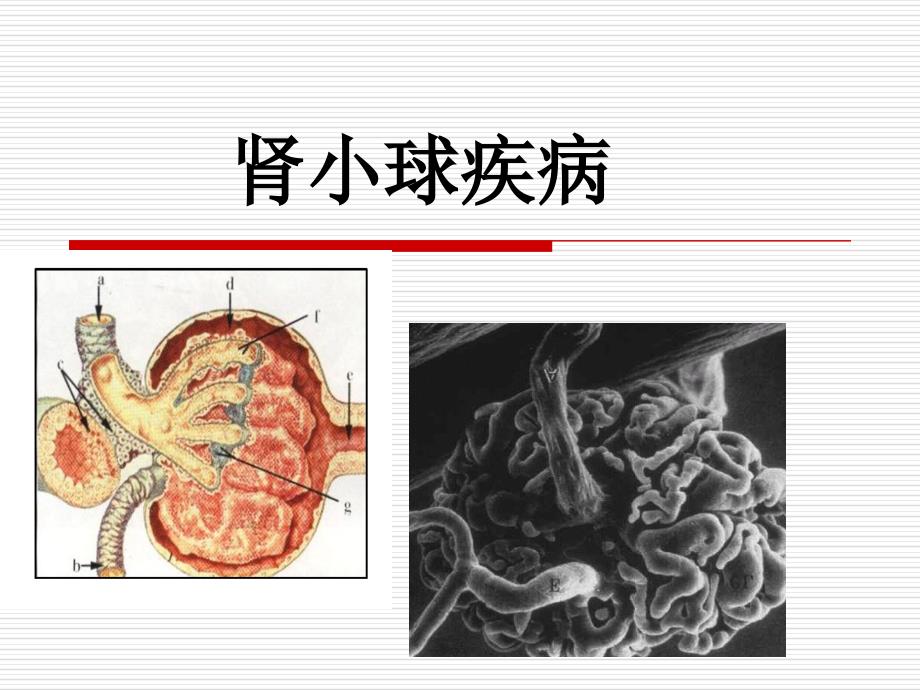 肾小球肾炎2011.3.21七年制-课件_第1页