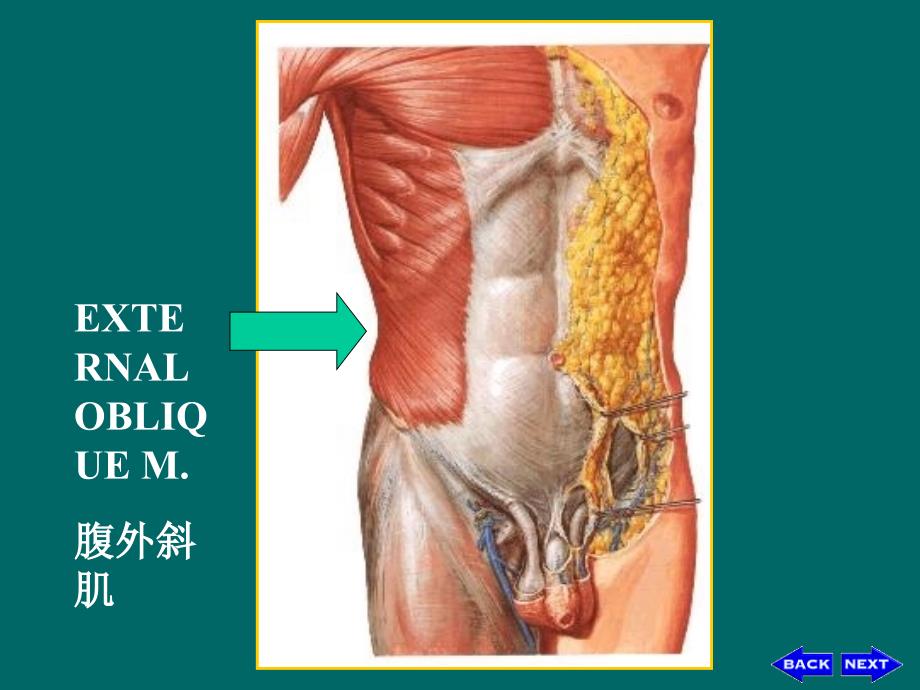 疝-腹股沟疝解剖图谱84817_第1页