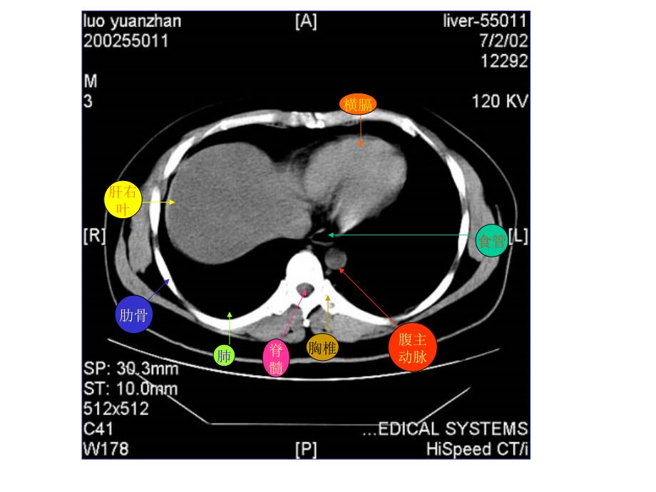 教你认识腹部CT课件_第1页
