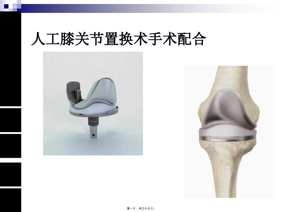 人工膝关节置换术手术配合四_第1页