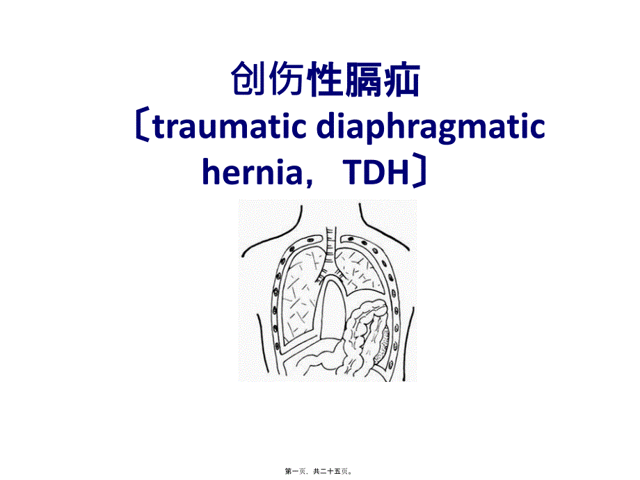 创伤性膈疝_第1页