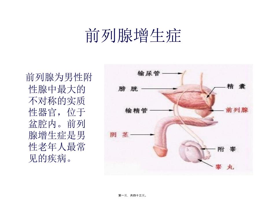 前列腺增生症四_第1页