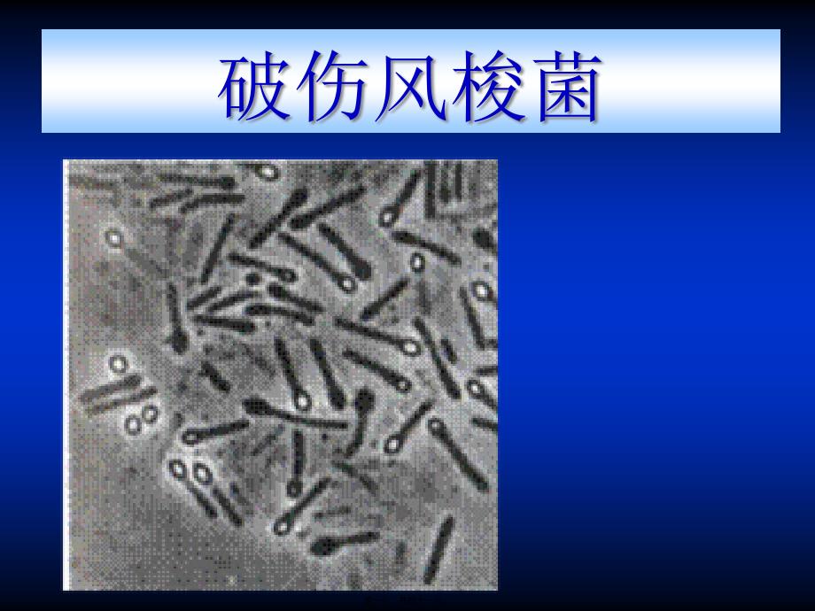 破伤风梭菌资料_第1页