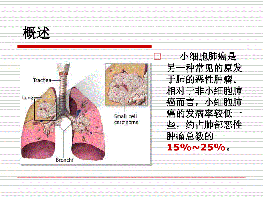 医学课件小细胞肺癌专业医学知识宣讲_第1页