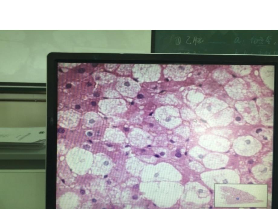 病理学实验切片考试图片_第1页