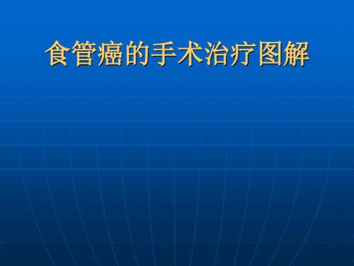 食管癌的手術(shù)治療圖解