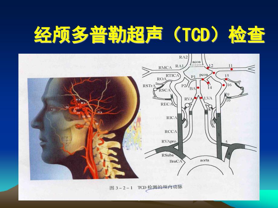 TCD体检教学讲解课件_第1页