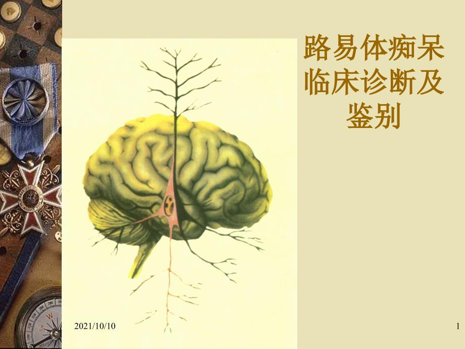 路易体痴呆临床诊断与鉴别PPT_第1页